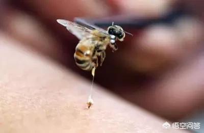 被蜜蜂蛰了怎么处理瘙痒怎么办:被蜜蜂蛰了好痒该如何处理？