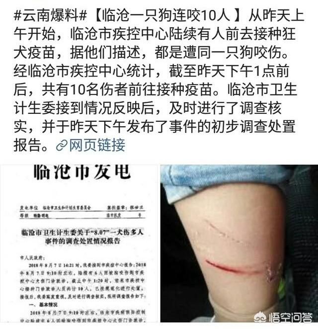 搜索卡西莫多犬:云南临沧一犬咬伤多人，目前有10人就诊，你怎么看？