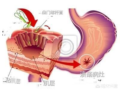 胃肠不好的人可以吃糯米吗，吃了冷糯米团后感到胃胀是怎么回事