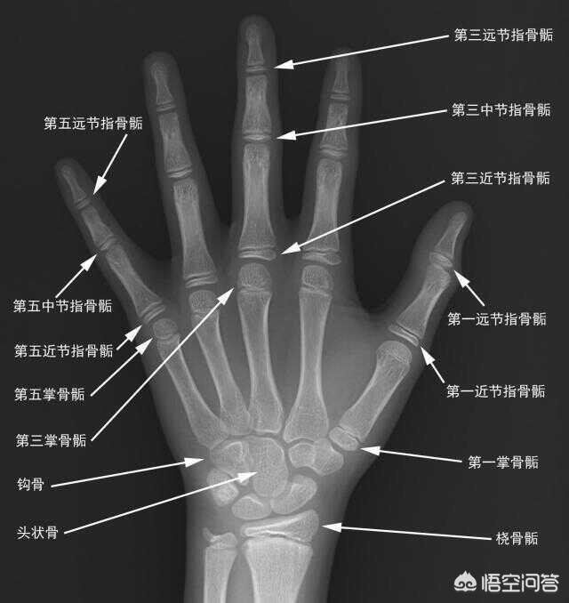 蜂蜜水止咳吗(萝卜蜂蜜水止咳吗)