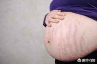 为什么少女会有腹中线，6个月的孕妇，为什么没有出现妊娠线呢