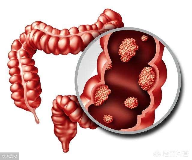 胃出血有什么症状:胃出血有什么症状,怎么治疗