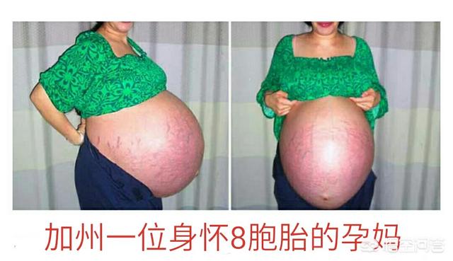 高圆圆孕肚照曝光:为什么有人怀孕的时候肚子大，而有人怀孕的时候肚子小？