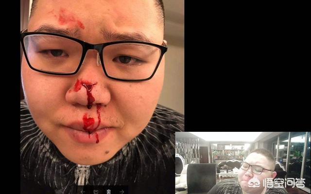 死亡宣告拿刀砍五五开:如果和寒夜对喷是的死亡宣告或者PDD，结局会怎样？