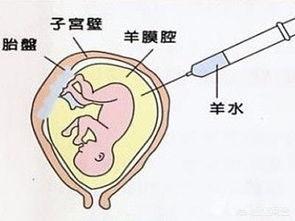 钟丽缇错失第四胎:48岁钟丽缇积极备孕第四胎，高龄妈妈怀孕要注意哪些问题？