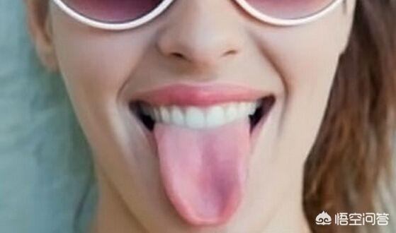 舌头胖大有齿痕，需要怎么调理？插图32