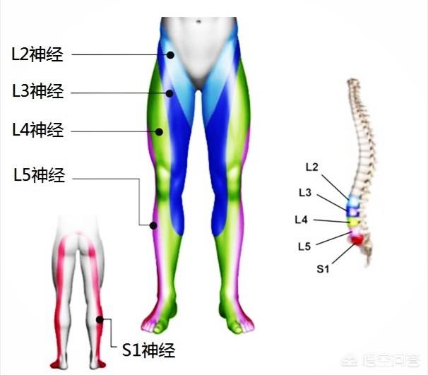 头条问答 腰椎盘膨出的一般体征有哪些 23个回答