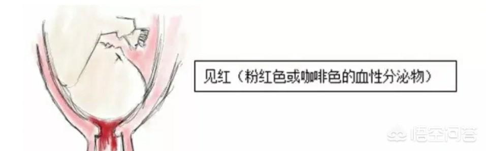 赵丽颖生孩子出血照片:生孩子时是先见红还是先破水？