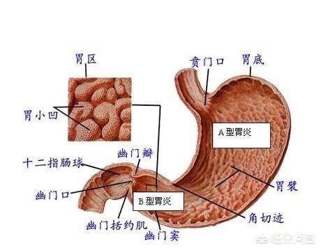 胃肠不好的人可以吃糯米吗，吃了冷糯米团后感到胃胀是怎么回事