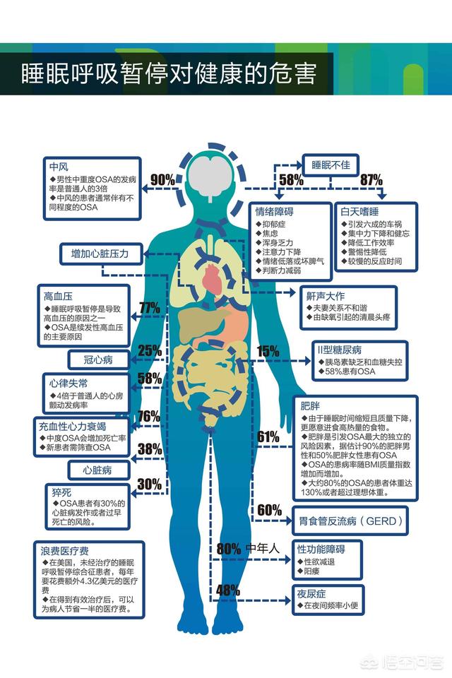 打呼噜怎么治小窍门:如何说服老公治疗打呼噜？