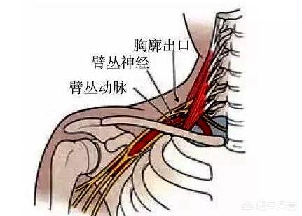 手指发麻是怎么回事儿，手指发麻怎么办是什么原因