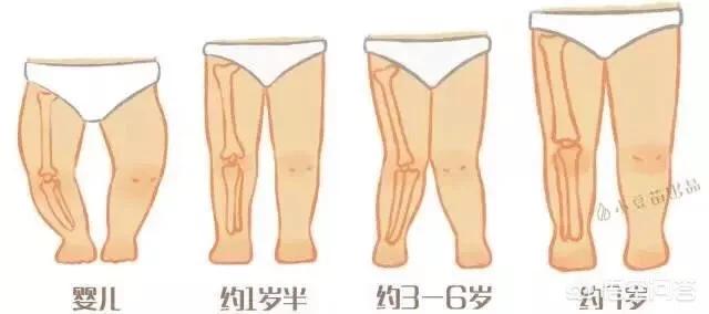 纸尿裤会导致宝宝O型腿吗，给宝宝穿纸尿裤的时候，会不会引起o型腿？