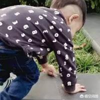 头条问答 宝宝关节脱臼怎么办 个回答