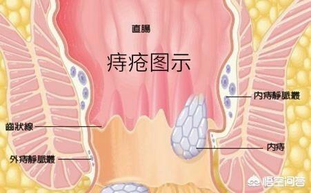 头条问答 