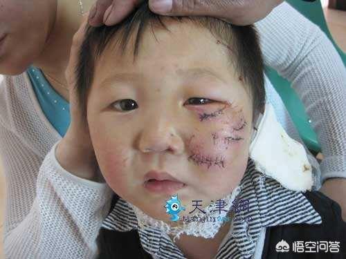 拦车救狗辩论:如何看待贵阳某小区宠物被“团灭”？ 高速拦车救狗