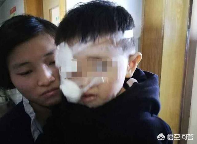 拦车救狗辩论:如何看待贵阳某小区宠物被“团灭”？ 高速拦车救狗