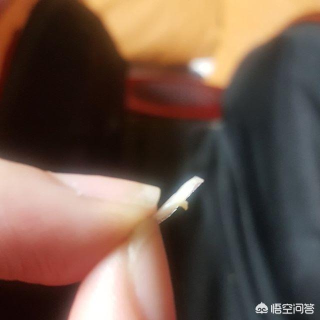 怎么祛青春痘,怎么祛青春痘最有效的方法