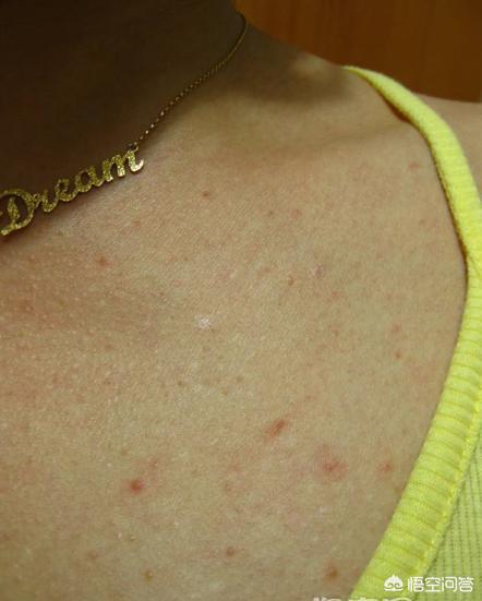 洗到胸前后背的时候,就感觉在抚摸一个癞蛤蟆皮一样(我就是这么觉得)