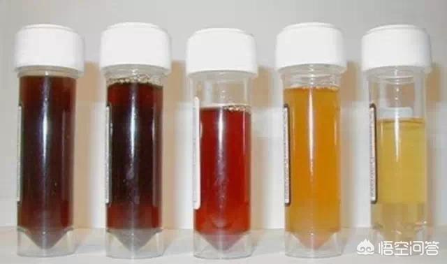 宝宝的尿有点红色这是血尿吗问题大吗