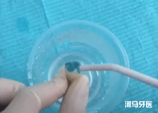 窝沟,孩子没蛀牙，要不要做窝沟封闭？
