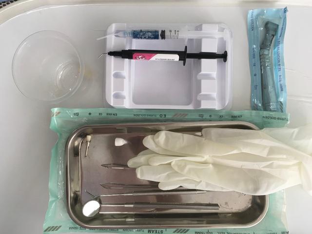 窝沟,孩子没蛀牙，要不要做窝沟封闭？