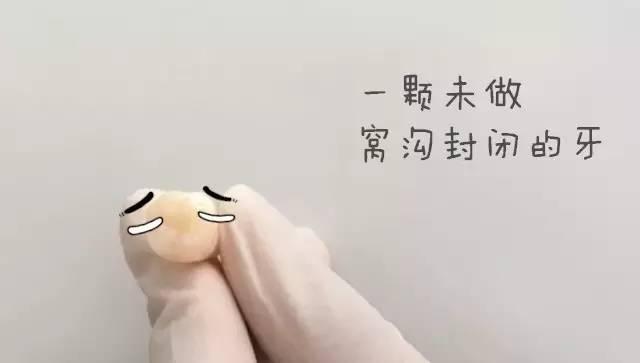 窝沟,孩子没蛀牙，要不要做窝沟封闭？