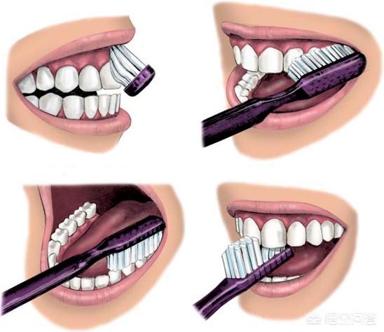 口臭的治疗(口臭的治疗方法)