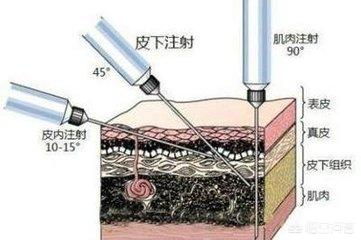 头条问答- 小猫打针时会痛吗？(1个回答)