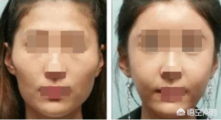 李小璐丰胸:为什么李小璐的形象突然崩塌了