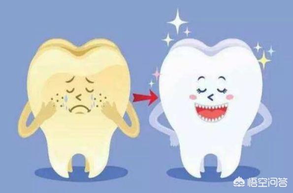 美白牙贴究竟靠谱吗，大家觉得美白类的牙齿贴有用吗如何让牙齿变白