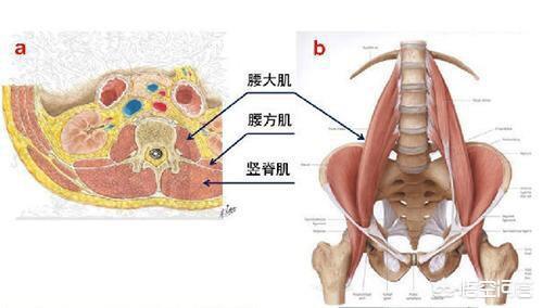 头条问答 - 如果一个人有腰间盘突出,椎管狭窄和骨质增生,应该怎么