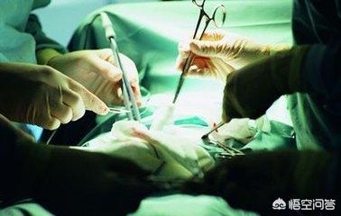 男性结扎的好处和坏处:生了二胎后不想要孩子了，做结扎对身体好不好？