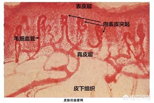 作激光能净化血液吗:脸上的红血丝可以去掉吗？
