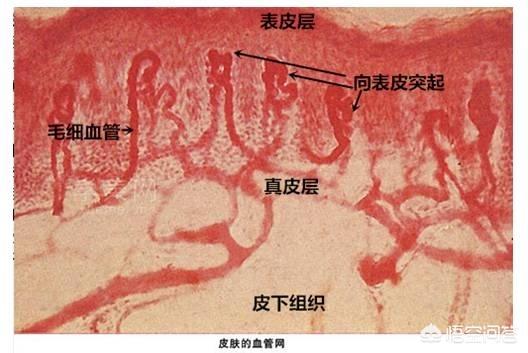 怎么去脸上的红血丝(治疗脸部红血丝最有效的方法)