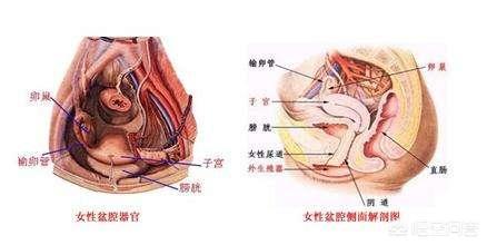 盆腔炎治疗方法(女性盆腔炎怎么治)