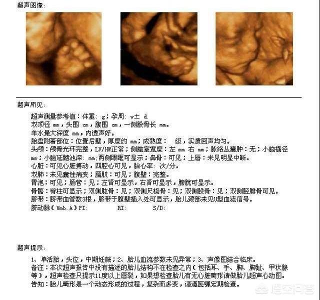 初怀孕多久能做b超:初孕多久可以做b超 第一次做B超应该是怀孕多久之后？