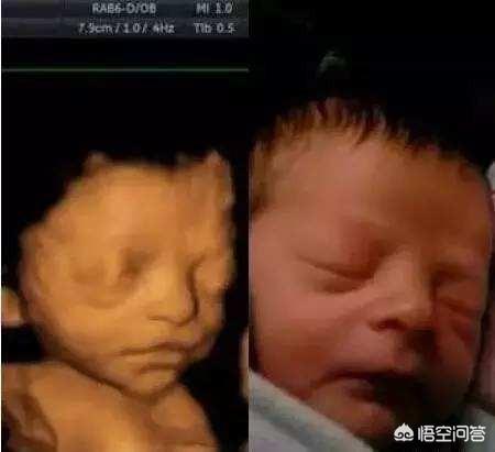 四维世界的照片 太震撼了，打四维宝宝的图片和生下宝宝的相貌有区别吗