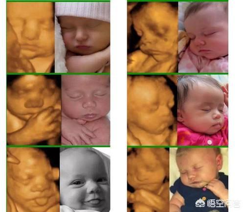 四维世界的照片 太震撼了，打四维宝宝的图片和生下宝宝的相貌有区别吗