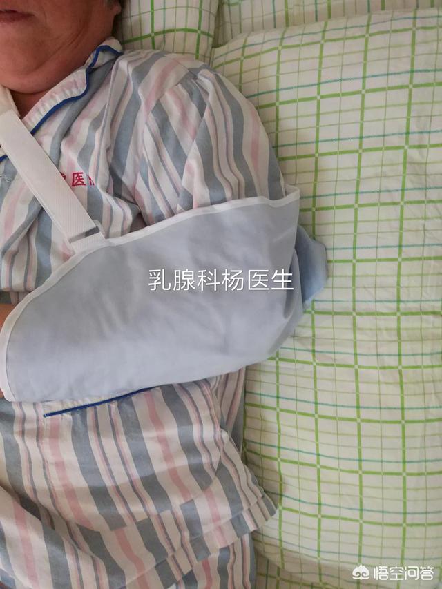乳腺切除手术:乳腺癌手术切除后，后续化疗在乳腺外科做好，还是在肿瘤科做好？