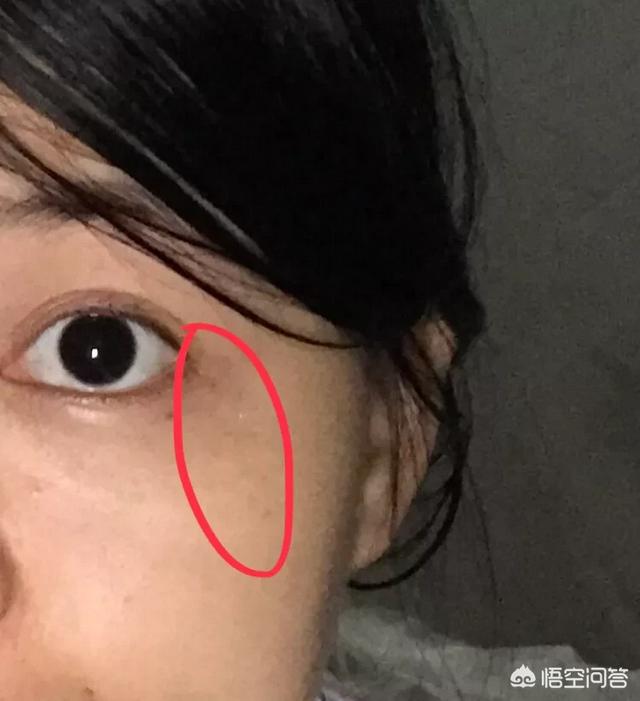以前年轻脸上没有斑现在脸上斑点特别多,应该怎么办？