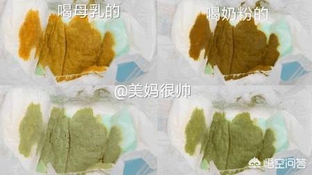 婴儿胆道阻塞的症状:如何从宝宝的便便来判断宝宝的消化情况？