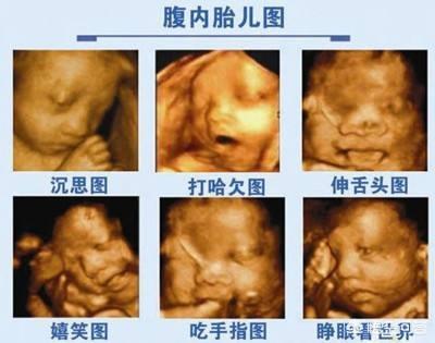 关晓彤十个月怀孕照片:谁有怀孕7个月胎儿头图片，需要正常的？