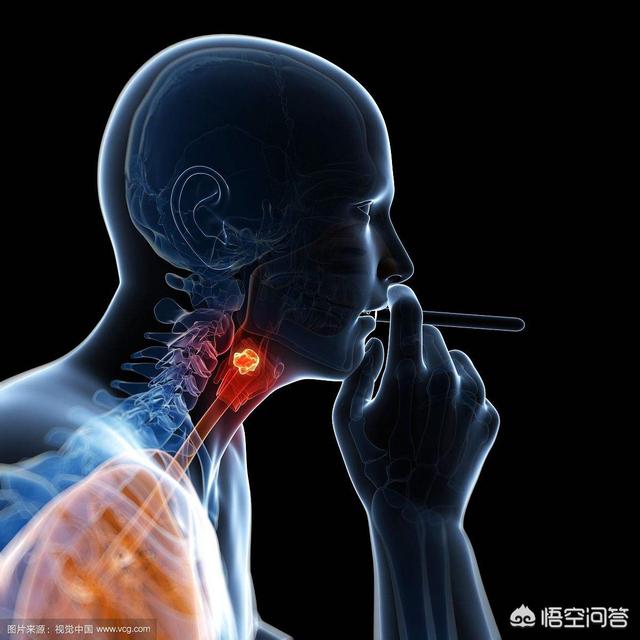 李咏得了什么病:李咏到底是因为什么癌去世的？