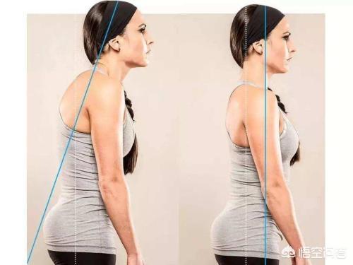 下垂胸怎么矫正，怎么把胸下垂的弄回来