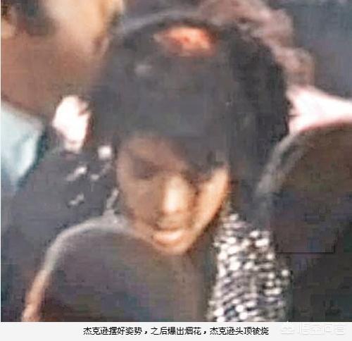 迈克尔杰克逊去世:迈克杰克逊是怎么去世的？