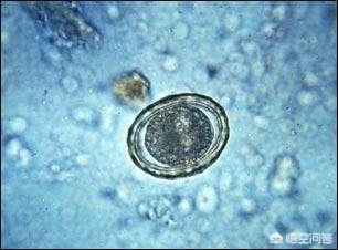 牛肉绦虫卵:怀孕期间能吃羊肉跟牛肉吗？