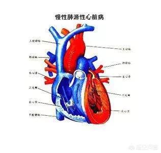 心肺病:心肺病变症状有哪些 患有心肺病的老人白天爱睡觉，晚上睡觉少是什么原因？