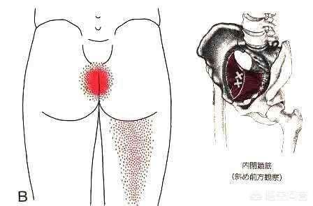 女生尾巴根疼是什么原因:尾巴骨根部酸痛，应该怎么办？