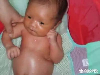 鼓腹巨蝰怎么读:新生儿出生十五天了，肚子特别鼓，是怎么回事？
