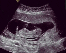 胎动在拱是胎儿在做什么，胎动在拱是胎儿在干嘛胎动一般从几个月开始就会明显了